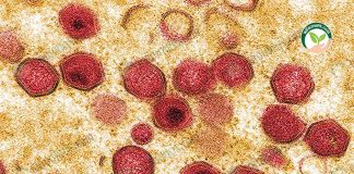 เชื้อไวรัสอหิวาต์แอฟริกา โรคasf ที่เข้าไปทำลายเซลล์ในร่างกายของหมู