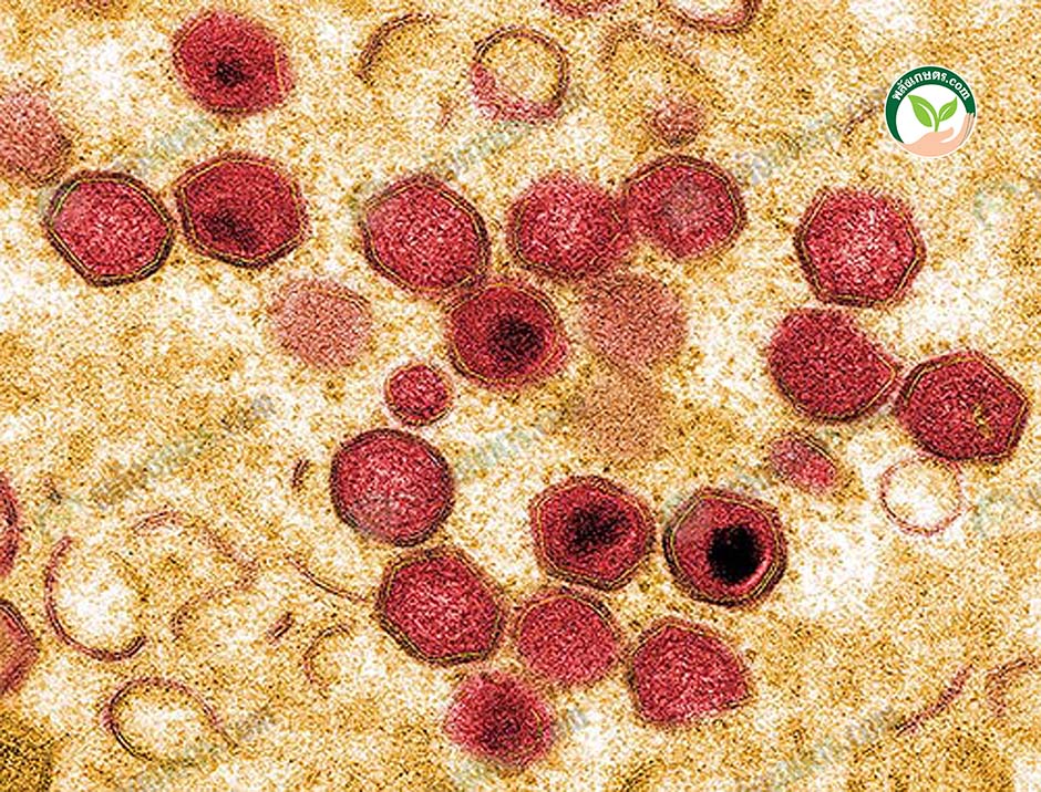 3.เชื้อไวรัสอหิวาต์แอฟริกา โรคasf ที่เข้าไปทำลายเซลล์ในร่างกายของหมู